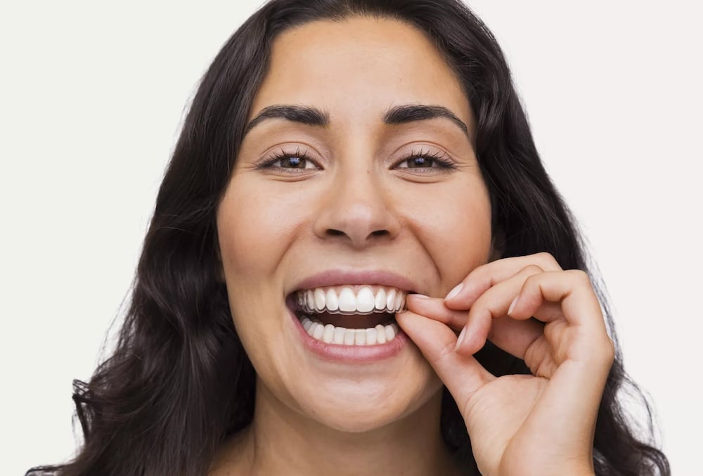 clarity clear aligners